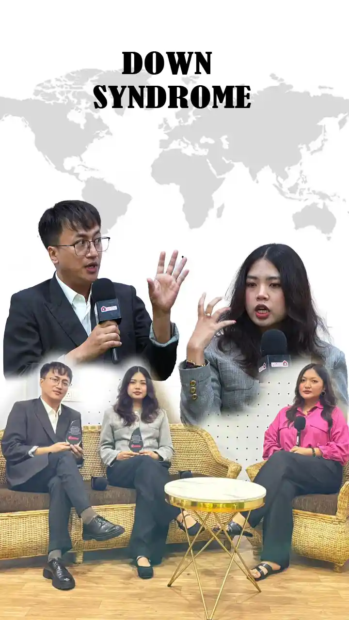 DOWN SYNDROME CHUNGCHANG || PC. LALRUATSANGA & LALBIAKZUALI FINATE || KAWMNA